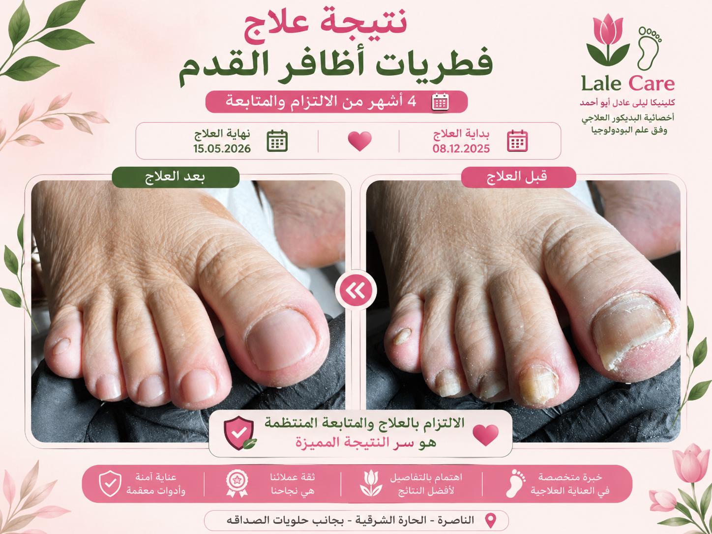 نتيجة علاج — 1